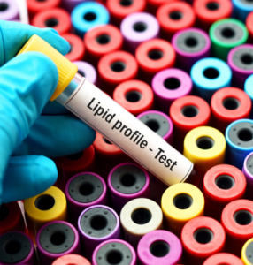 Lipid Profile