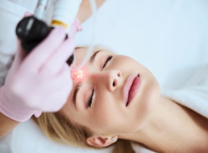 Fractional Laser Resurfacing