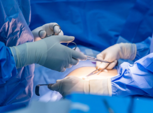 laprotomy