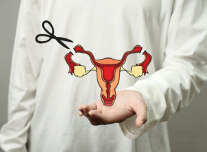 tubectomy