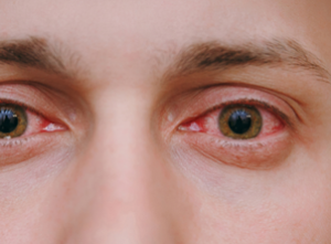 Neuro ophthalmology services