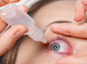 Glaucoma