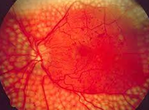 Orbit and Oculoplasty services