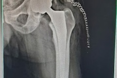 IMG-20230103-WA0023__01